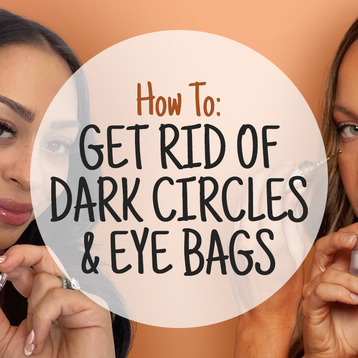 How to Get Rid of Dark Circles & Eye Bags