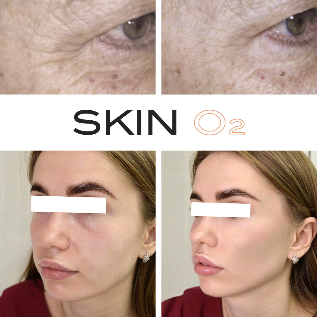 Peptide Eye Cream + Platinum Eyelift