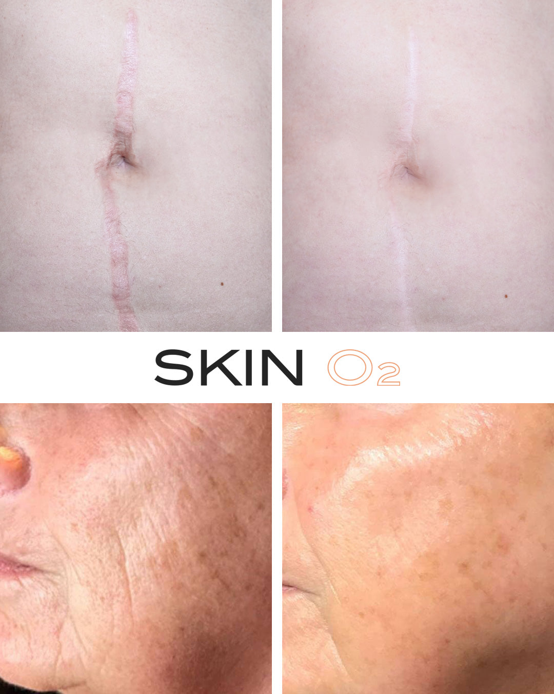 Multi Vit B, A, C, E Moisturiser