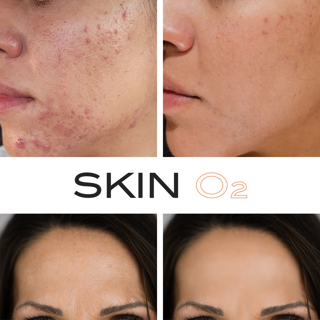 2% Retinol Fullerene Serum
