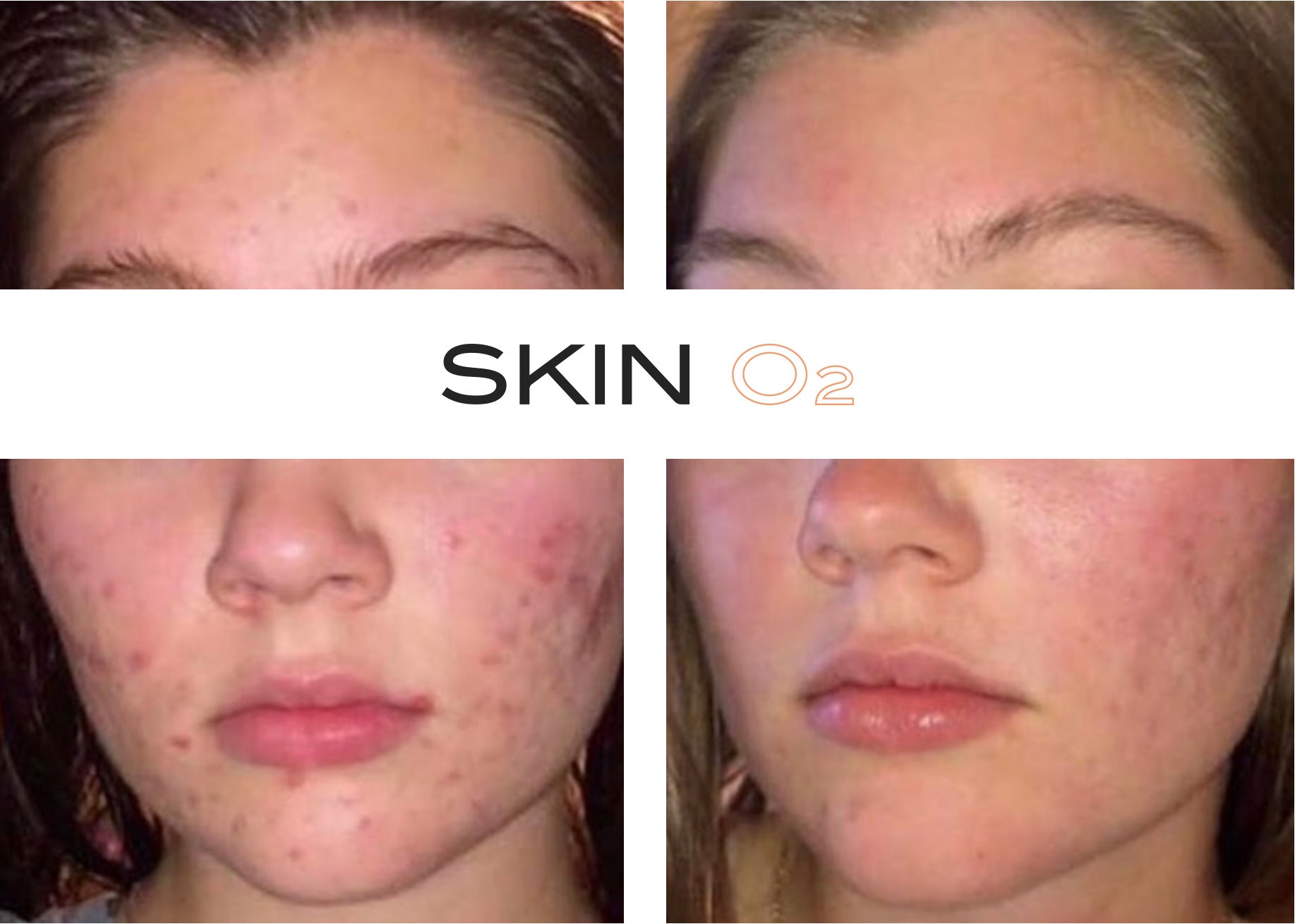 2% Retinol Fullerene Serum