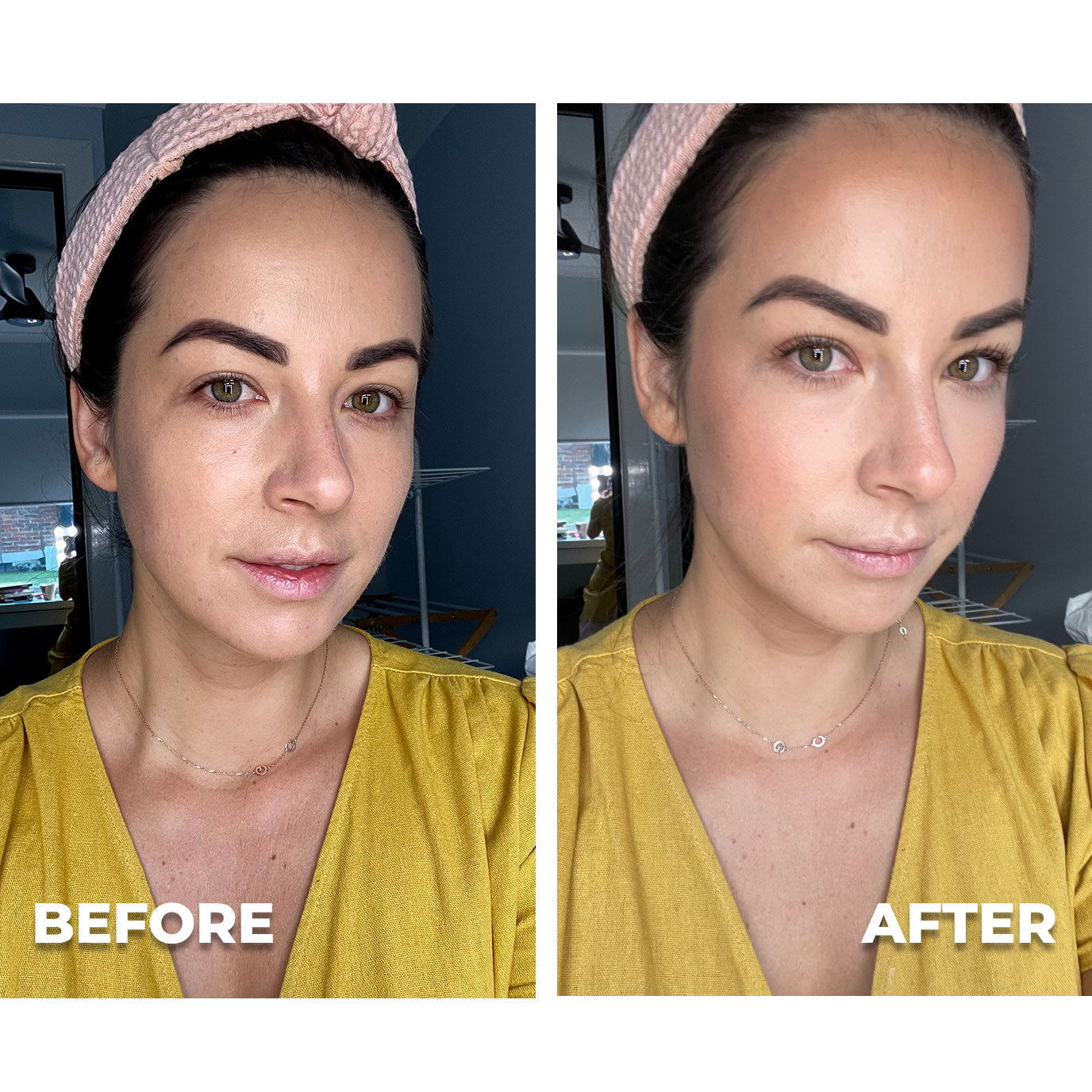 Anti-Acne Spot Cream + Free Concealer (Zit Kit)