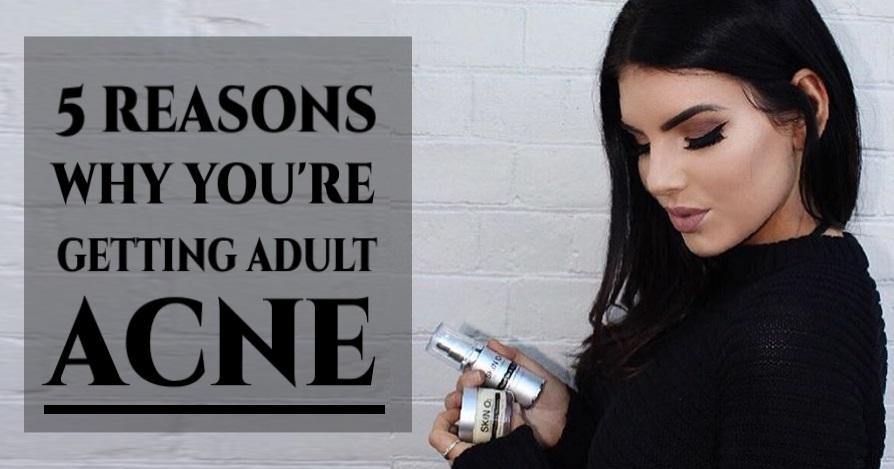 5 Reasons Why You’re Getting Adult Acne - Skin O2