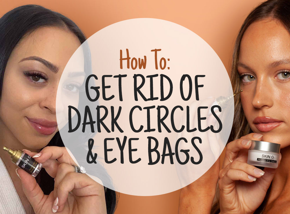 How to Get Rid of Dark Circles & Eye Bags