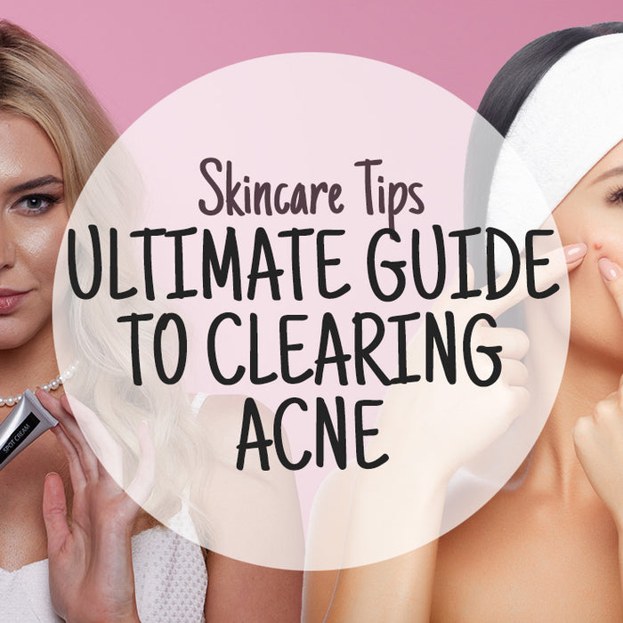 The Ultimate Guide to Clearing Acne
