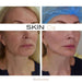 Skin Gym - Face & Body Toner+ Derma Fill - Skin O2
